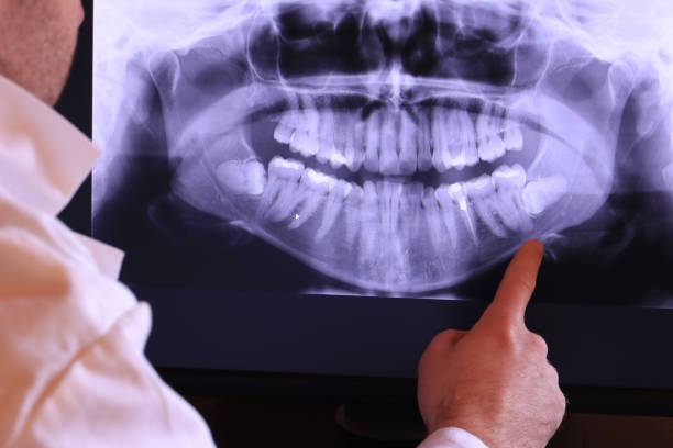 Best Holiday Emergency Dentist in Bassett, VA