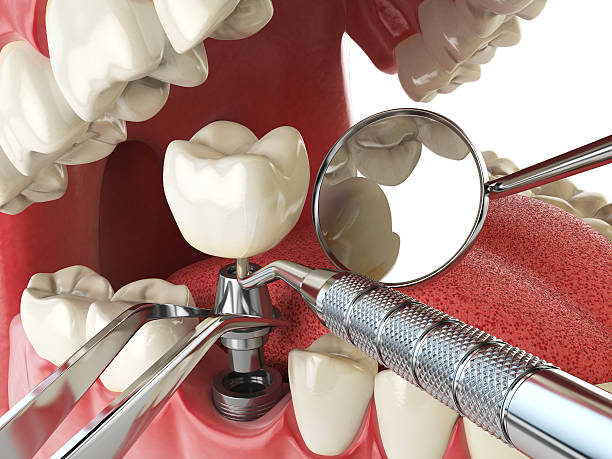 Best Emergency Dentist for Special Needs Patients in Bassett, VA